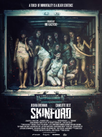 skinford